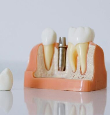 Hypnotherapy for needle phobia at the dentist 
